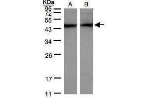 WB Image Sample(30 μg of whole cell lysate) A:HeLa S3, B:MOLT4, 12% SDS PAGE antibody diluted at 1:500