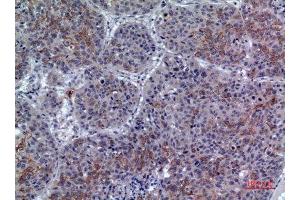 Immunohistochemistry (IHC) analysis of paraffin-embedded Human Lung, antibody was diluted at 1:100. (LILRA1 anticorps  (N-Term))