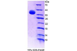 SDS-PAGE analysis of Human GBP4 Protein. (GBP4 Protéine)