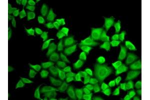 Immunofluorescence analysis of A-549 cells using DHFR antibody (ABIN3022227, ABIN3022228, ABIN3022229 and ABIN6218683).