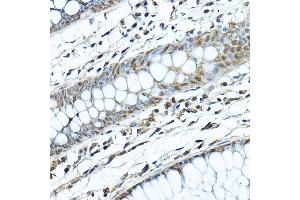 Immunohistochemistry of paraffin-embedded human colon using [KO Validated] SIRT1 Rabbit pAb (ABIN6129328, ABIN6147784, ABIN6147785 and ABIN6215138) at dilution of 1:200 (40x lens). (SIRT1 anticorps  (AA 448-747))