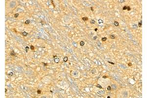 ABIN6259156 and ABIN6275313 at 1/100 staining Rat brain tissue by IHC-P. (PPP1R8 anticorps  (Internal Region))