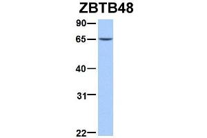 Host:  Rabbit  Target Name:  ZBTB48  Sample Type:  293T  Antibody Dilution:  1. (ZBTB48 anticorps  (N-Term))