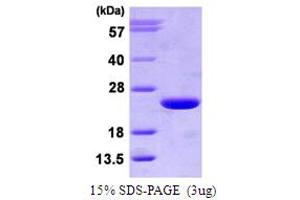SDS-PAGE (SDS) image for ADP-Ribosylation Factor 3 (ARF3) (AA 1-181) protein (His tag) (ABIN666643)