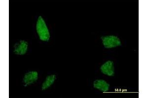 Immunofluorescence of purified MaxPab antibody to BANP on HeLa cell.