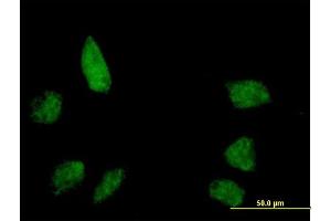 Immunofluorescence of purified MaxPab antibody to BANP on HeLa cell. (BANP anticorps  (AA 1-469))