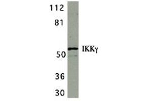 Western Blotting (WB) image for anti-Inhibitor of kappa Light Polypeptide Gene Enhancer in B-Cells, Kinase gamma (IKBKG) (C-Term) antibody (ABIN1030433) (IKBKG anticorps  (C-Term))