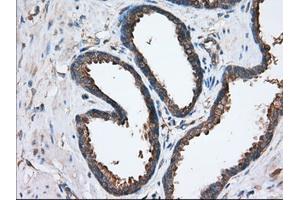 Immunohistochemistry (IHC) image for anti-Sorting Nexin 9 (SNX9) antibody (ABIN1501048)