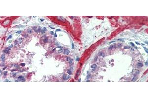Immunohistochemistry with Human Prostate lysate tissue at an antibody concentration of 5. (IGFBP4 anticorps  (Middle Region))