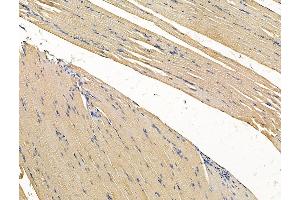ABIN7096273 and ABIN7100335 at 1/100 staining rat muscle tissue by IHC-P. (VWA5B2 anticorps)