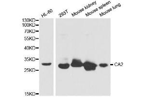 Western blot analysis of extracts of various cell lines, using CA2 antibody. (CA2 anticorps  (AA 1-250))