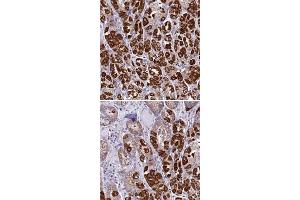 Immunohistochemical staining of human stomach with KCNG1 polyclonal antibody  shows strong cytoplasmic positivity in glandular cells.