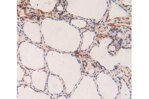 Figure. (Caspase 3 anticorps  (AA 29-175))