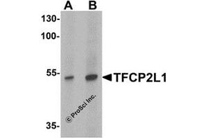 Western Blotting (WB) image for anti-Transcription Factor CP2-Like 1 (TFCP2L1) (N-Term) antibody (ABIN1031612)