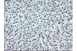 Immunohistochemical staining of paraffin-embedded lung tissue using anti-PLK1mouse monoclonal antibody. (PLK1 anticorps)
