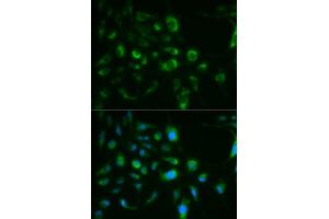 Immunofluorescence analysis of MCF7 cell using TLR8 antibody. (TLR8 anticorps)