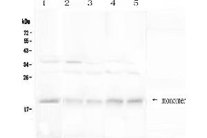 Western blot analysis of BAFF Receptor using anti-BAFF Receptor antibody . (TNFRSF13C anticorps  (AA 1-78))