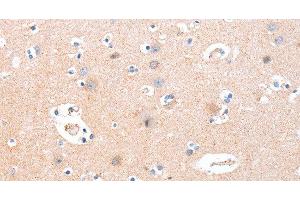 Immunohistochemistry of paraffin-embedded Human brain using B3GAT1 Polyclonal Antibody at dilution of 1:40 (CD57 anticorps)