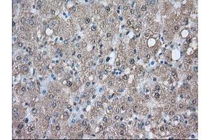 Image no. 3 for anti-Proto-Oncogene Pim-2 (Serine Threonine Kinase) (PIM2) antibody (ABIN1500220)