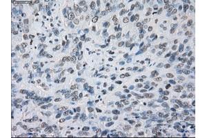 Immunohistochemical staining of paraffin-embedded colon tissue using anti-KDM4C mouse monoclonal antibody. (KDM4C anticorps)