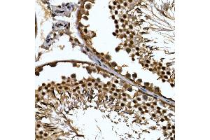 Immunohistochemistry of paraffin-embedded rat testis using ZNF384 Rabbit pAb (ABIN7271478) at dilution of 1:100 (40x lens). (ZNF384 anticorps  (AA 1-180))