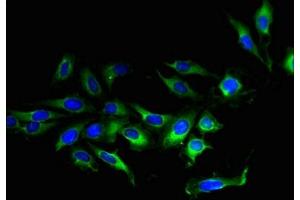 Immunofluorescent analysis of Hela cells using ABIN7173135 at dilution of 1:100 and Alexa Fluor 488-congugated AffiniPure Goat Anti-Rabbit IgG(H+L)