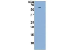 WB of Protein Standard: different control antibodies against Highly purified E. (Angiotensin I Converting Enzyme 1 Kit CLIA)