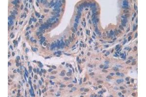 DAB staining on IHC-P; Samples: Mouse Uterus Tissue