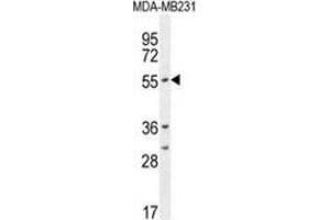 Western blot analysis in MDA-MB231 cell line lysates (35ug/lane) using CYP2A7  Antibody . (CYP2A7 anticorps  (Middle Region))