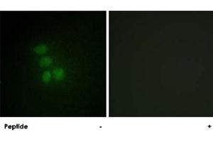 Immunofluorescence analysis of HepG2 cells, using RBMX polyclonal antibody . (RBMX anticorps  (N-Term))