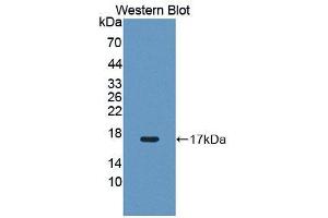 Western blot analysis of the recombinant protein. (PIM1 anticorps  (AA 38-177))