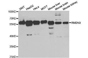 Western blot analysis of extracts of various cell lines, using RMDN3 antibody. (RMDN3 anticorps  (AA 171-470))