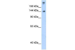 SF3B1 antibody used at 1. (SF3B1 anticorps  (N-Term))