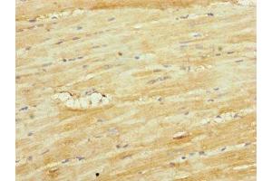 Immunohistochemistry of paraffin-embedded human heart tissue using ABIN7149113 at dilution of 1:100
