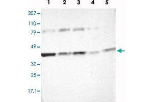 Western blot analysis of Lane 1: RT-4, Lane 2: EFO-21, Lane 3: A-431, Lane 4: Liver, Lane 5: Tonsil with IDH3G polyclonal antibody  at 1:250-1:500 dilution. (IDH3G anticorps)