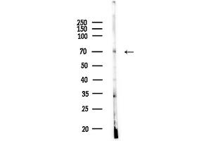 anti-Autophagy Related 16-Like 2 (ATG16L2) (Internal Region) antibody