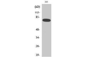 Western Blotting (WB) image for anti-Nuclear Factor-kB p65 (NFkBP65) (pSer468) antibody (ABIN3172939) (NF-kB p65 anticorps  (pSer468))