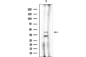 Western blot analysis of lysates from Rat lung, using ALS2CR2 Mouse Monoclonal Antibody at 1/1000 dilution.