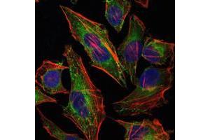 Immunofluorescence analysis of Hela cells using HSP27 mouse mAb (green).