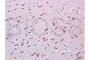 Formalin-fixed and paraffin embedded rat brain tissue labeled Anti-PEGF Polyclonal Antibody, Unconjugated (ABIN672456) at 1:200, followed by conjugation to the secondary antibody and DAB staining (PEDF anticorps  (AA 201-300))