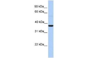 ZC3H15 antibody used at 0.
