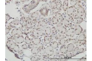 Image no. 1 for anti-Slingshot Homolog 3 (SSH3) (AA 293-392) antibody (ABIN599261) (SSH3 anticorps  (AA 293-392))