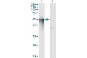 Western Blot analysis of ARMC6 expression in transfected 293T cell line by ARMC6 monoclonal antibody (M03), clone 2H8. (ARMC6 anticorps  (AA 1-476))