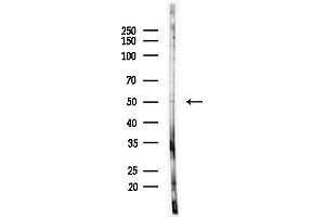 Western blot analysis of lysates from PC12 cells(starvation,24h treatment), using PLAGL1 Antibody at 1/1000 dilution.