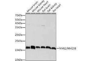 Western blot analysis of extracts of various cell lines, using NME2/NM23B Rabbit mAb (ABIN7269056) at 1:1000 dilution. (NME2 anticorps)