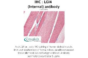 Image no. 3 for anti-Leucine-Rich Repeat LGI Family, Member 4 (LGI4) (Internal Region) antibody (ABIN1736431)