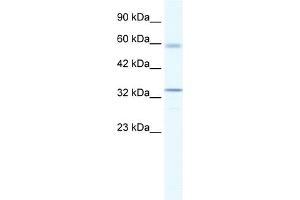 WB Suggested Anti-ZBTB7A Antibody Titration:  1. (ZBTB7A anticorps  (Middle Region))