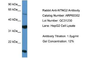 WB Suggested Anti-NTNG2  Antibody Titration: 0.