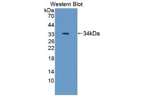 Western blot analysis of the recombinant protein. (Antizyme Inhibitor 1 anticorps  (AA 1-280))
