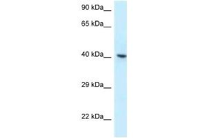 Western Blot showing RBMX antibody used at a concentration of 1 ug/ml against OVCAR-3 Cell Lysate (RBMX anticorps  (C-Term))